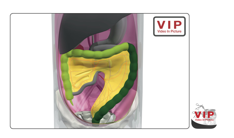 picture operation app