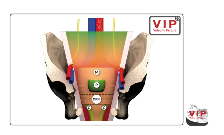 picture operation app